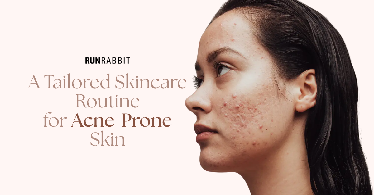 A Tailored Skincare Routine for Sensitive Acne-Prone Skin